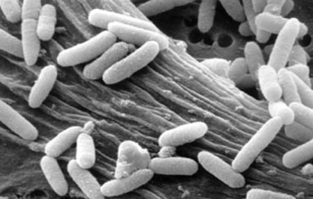 キッチンカー(移動販売)で気を付けたい細菌性食中毒の種類と対策について学ぼう！